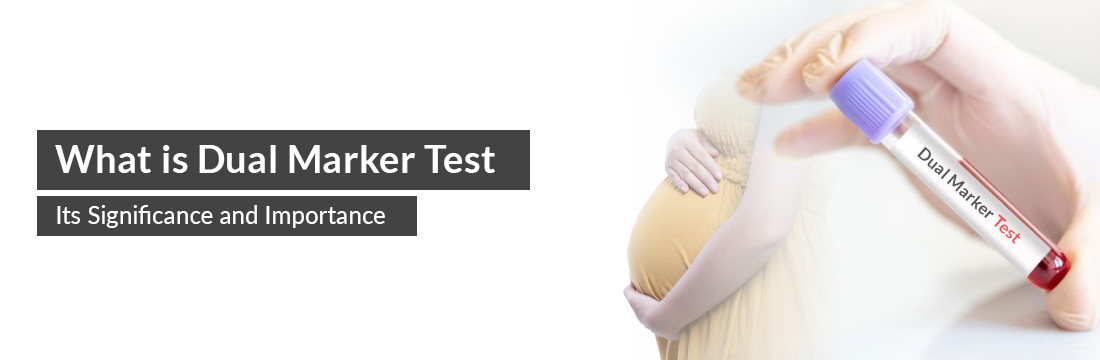 What is Dual Marker Test, Its Significance and Importance